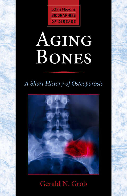 Book cover of Aging Bones: A Short History of Osteoporosis (Johns Hopkins Biographies of Disease)