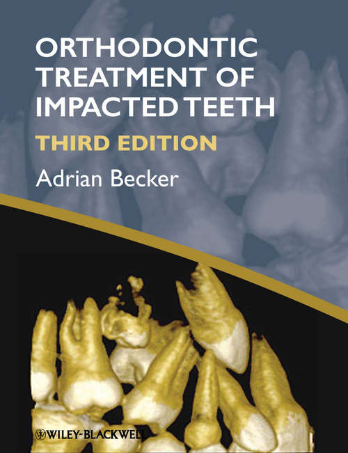 Book cover of Orthodontic Treatment of Impacted Teeth (3)