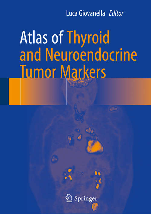 Book cover of Atlas of Thyroid and Neuroendocrine Tumor Markers