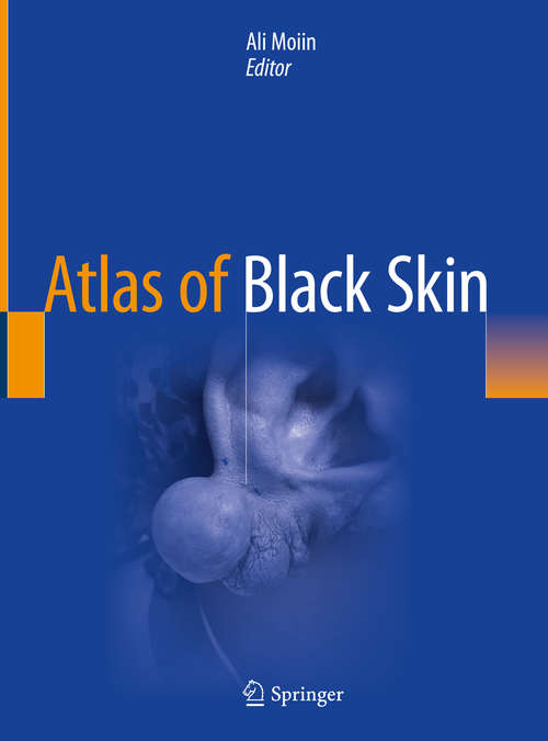 Book cover of Atlas of Black Skin (1st ed. 2020)