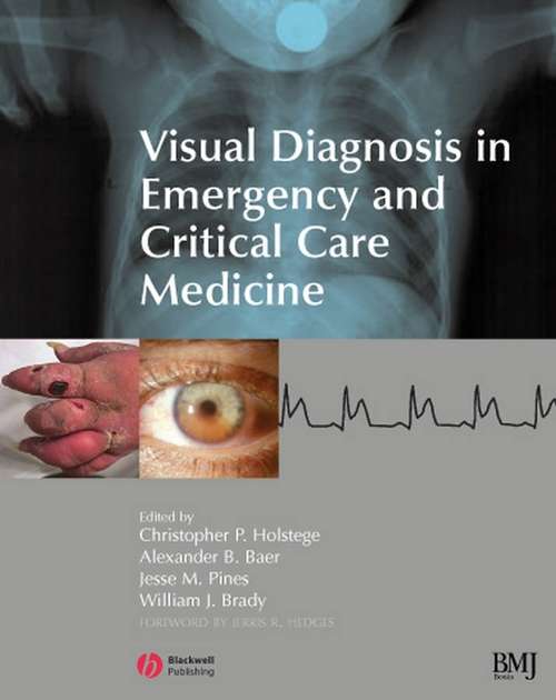 Book cover of Visual Diagnosis in Emergency and Critical Care Medicine (2)