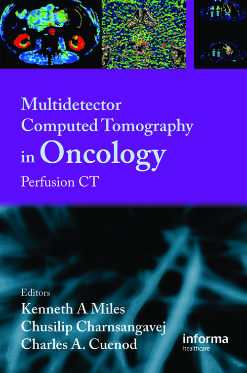 Book cover of Multi-Detector Computed Tomography in Oncology: CT Perfusion Imaging (1)