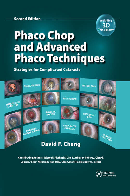 Book cover of Phaco Chop and Advanced Phaco Techniques: Strategies for Complicated Cataracts