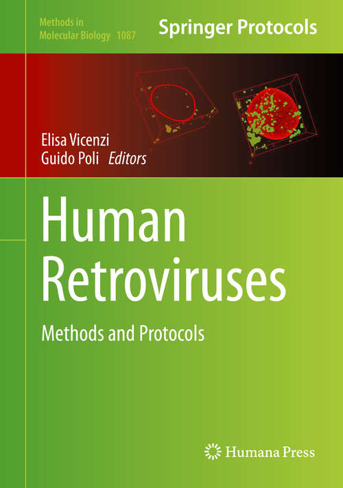 Book cover of Human Retroviruses