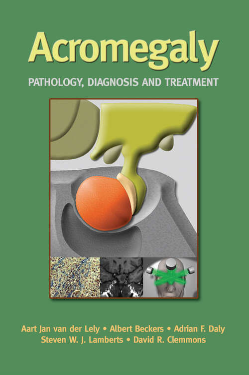 Book cover of Acromegaly: Pathology, Diagnosis and Treatment