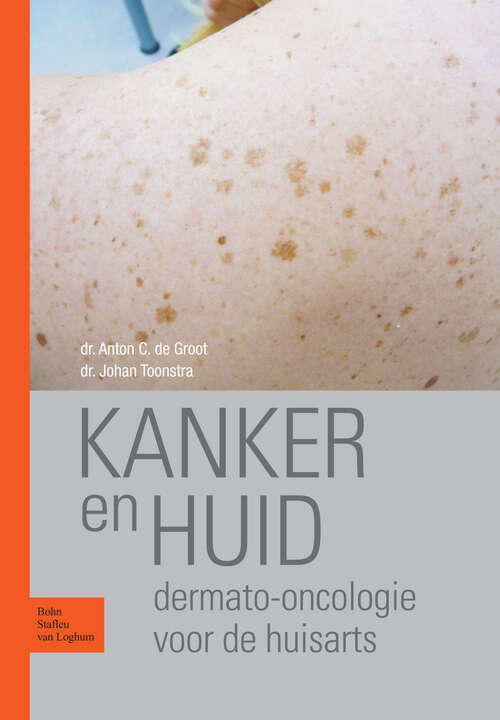 Book cover of Kanker en huid