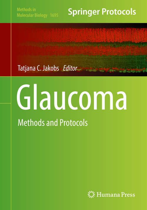 Book cover of Glaucoma