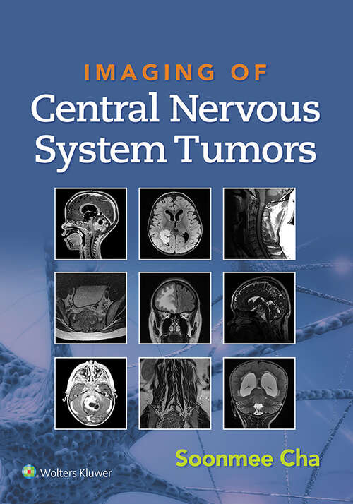 Book cover of Imaging of Central Nervous System Tumors