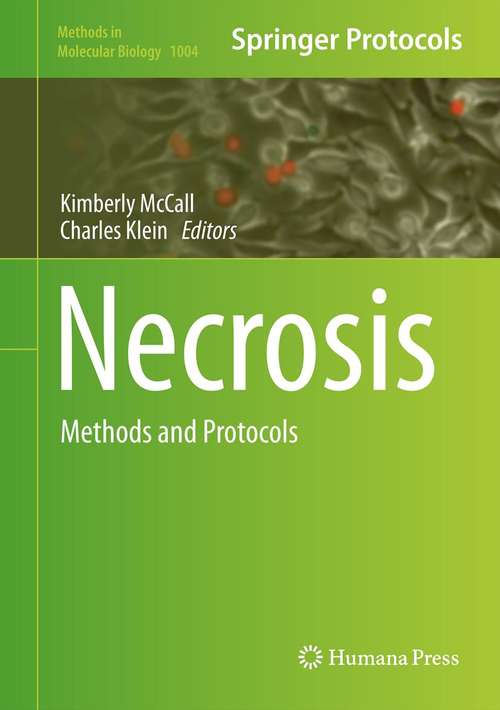 Book cover of Necrosis: Methods and Protocols (2013) (Methods in Molecular Biology #1004)