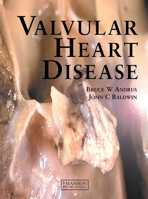 Book cover of Valvular Heart Disease