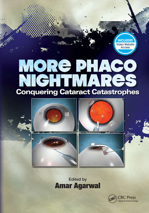 Book cover of More Phaco Nightmares: Conquering Cataract Catastrophes