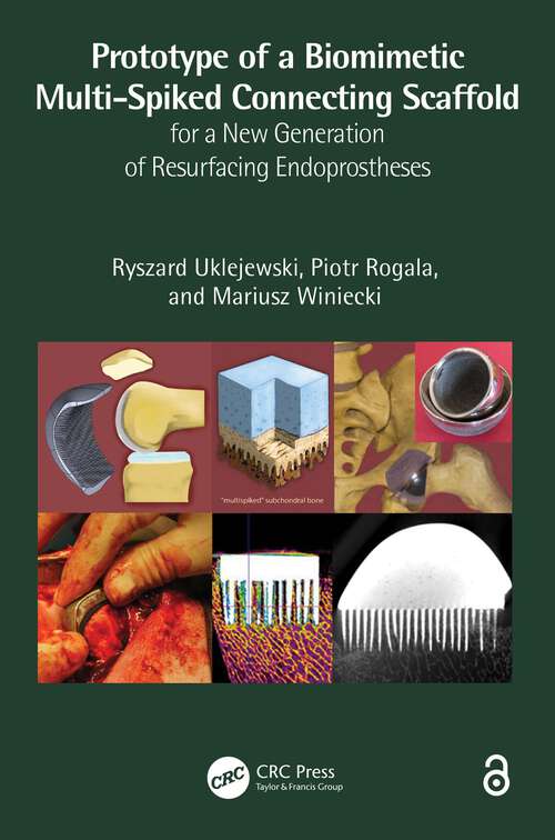 Book cover of Prototype of a Biomimetic Multi-Spiked Connecting Scaffold for a New Generation of Resurfacing Endoprostheses