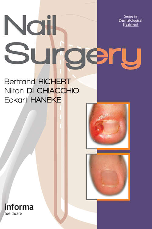 Book cover of Nail Surgery (Series in Dermatological Treatment)