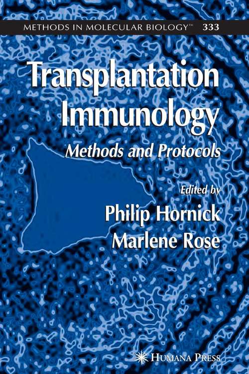 Book cover of Transplantation Immunology