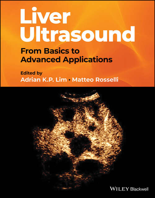 Book cover of Liver Ultrasound: From Basics to Advanced Applications
