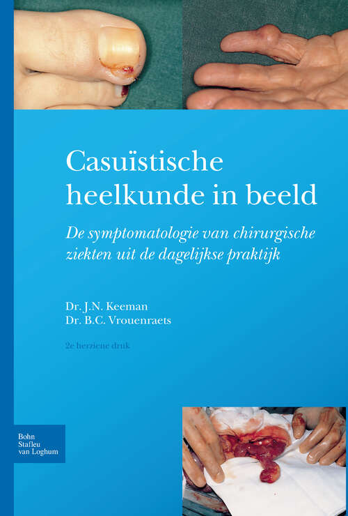 Book cover of Casuïstische heelkunde in beeld: Symptomatologie van chirurgische ziekten in de dagelijkse praktijk