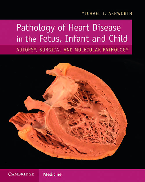 Book cover of Pathology of Heart Disease in the Fetus, Infant and Child: Autopsy, Surgical and Molecular Pathology