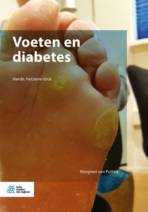 Book cover of Voeten en diabetes (4th ed. 2018)