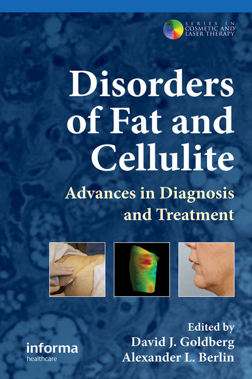 Book cover of Disorders of Fat and Cellulite: Advances in Diagnosis and Treatment (Series in Cosmetic and Laser Therapy)