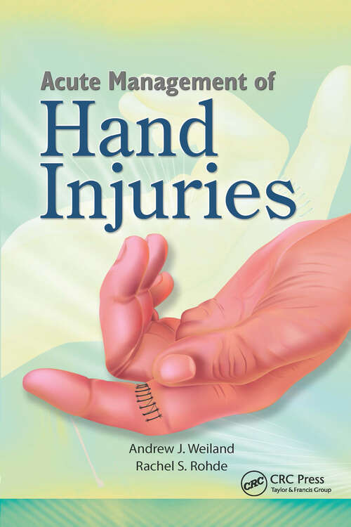 Book cover of Acute Management of Hand Injuries