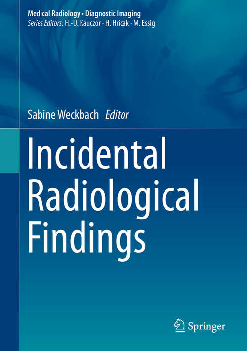 Book cover of Incidental Radiological Findings