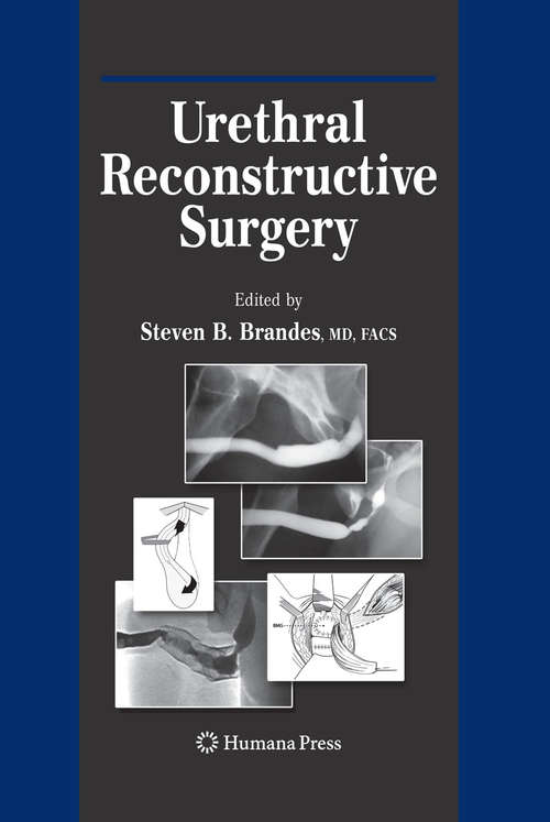 Book cover of Urethral Reconstructive Surgery