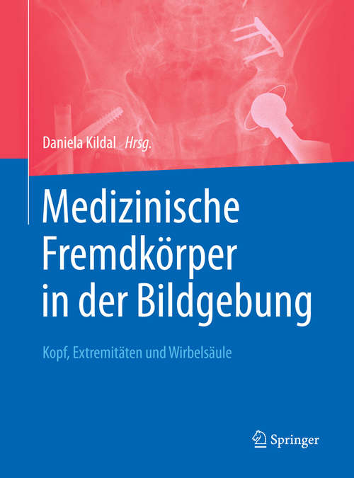 Book cover of Medizinische Fremdkörper in der Bildgebung