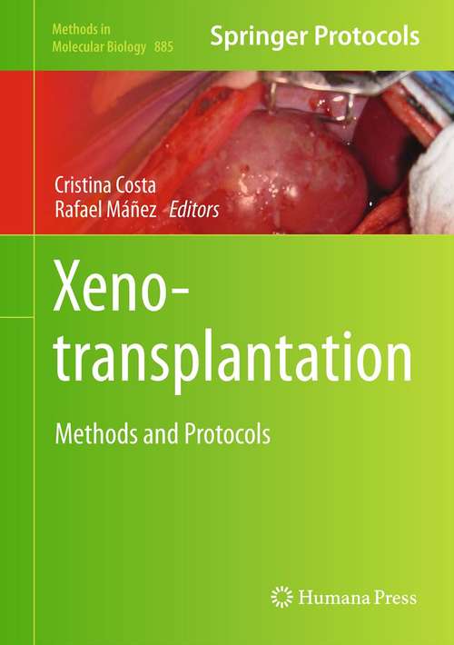 Book cover of Xenotransplantation