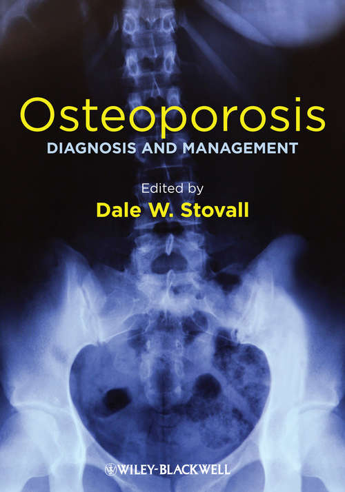 Book cover of Osteoporosis