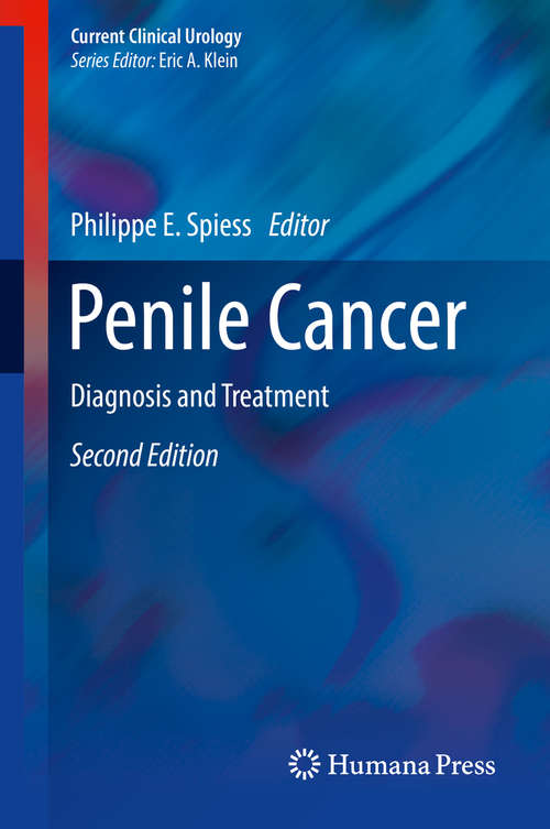 Book cover of Penile Cancer