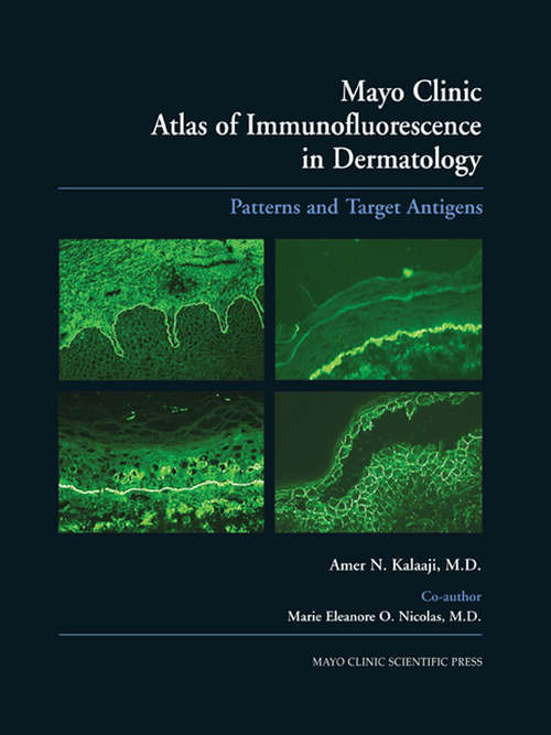 Book cover of Mayo Clinic Atlas of Immunofluorescence in Dermatology: Patterns and Target Antigens