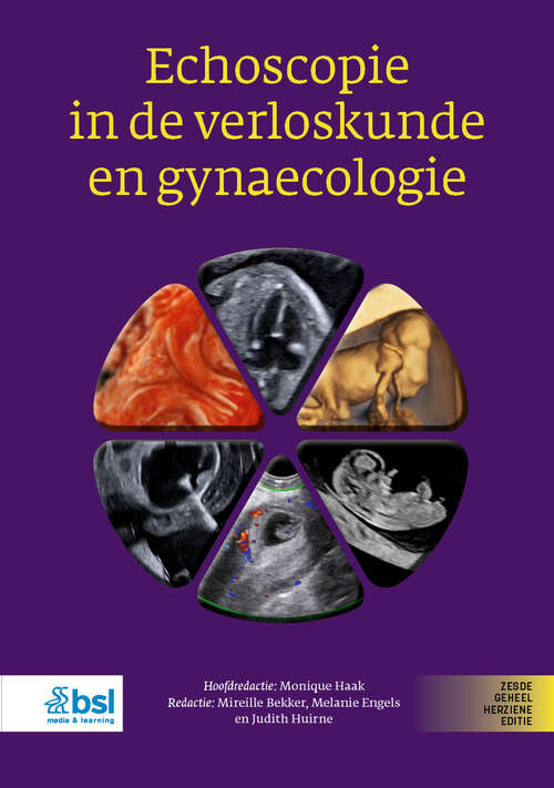 Book cover of Echoscopie in de verloskunde en gynaecologie (Sixth Edition 2025)