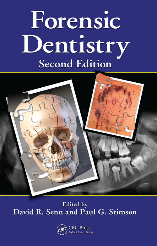 Book cover of Forensic Dentistry