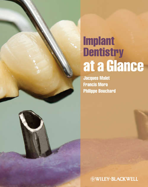 Book cover of Implant Dentistry at a Glance (2) (At a Glance #60)