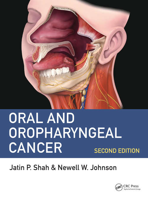 Book cover of Oral and Oropharyngeal Cancer (2)