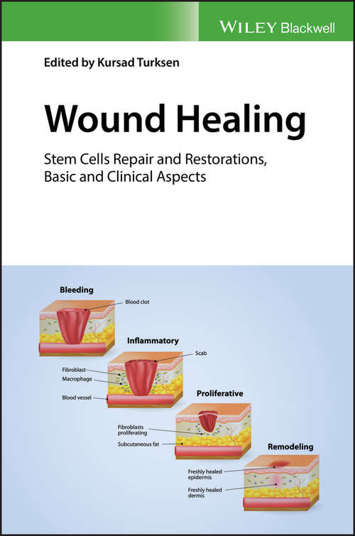 Book cover of Wound Healing: Stem Cells Repair and Restorations, Basic and Clinical Aspects