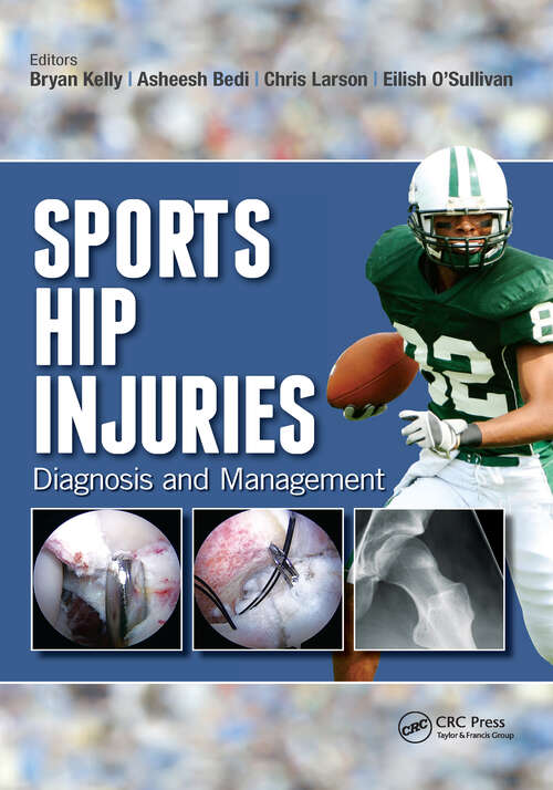 Book cover of Sports Hip Injuries: Diagnosis and Management