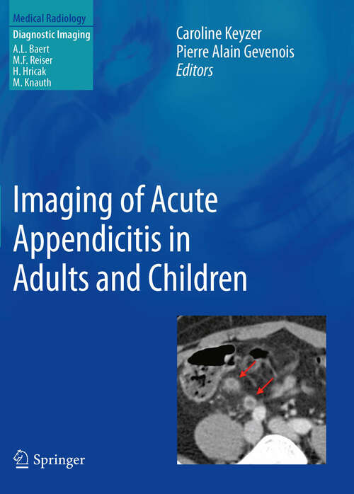 Book cover of Imaging of Acute Appendicitis in Adults and Children