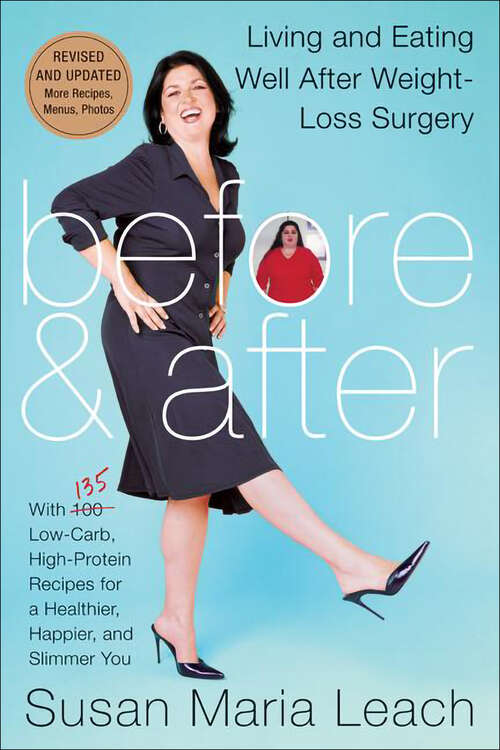 Book cover of Before & After: Living and Eating Well After Weight-Loss Surgery