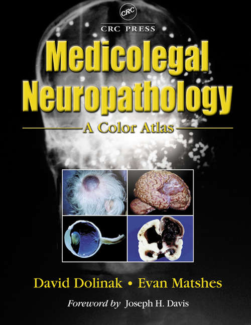 Book cover of Medicolegal Neuropathology: A Color Atlas