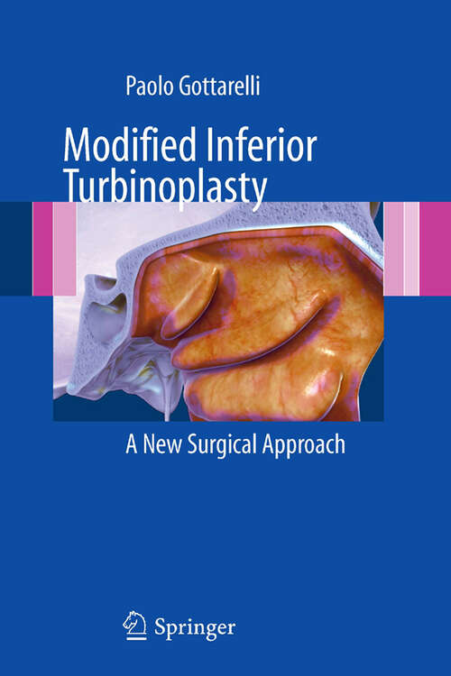 Book cover of Modified Inferior Turbinoplasty