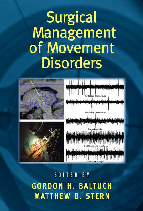 Book cover of Surgical Management of Movement Disorders (Neurological Disease and Therapy)