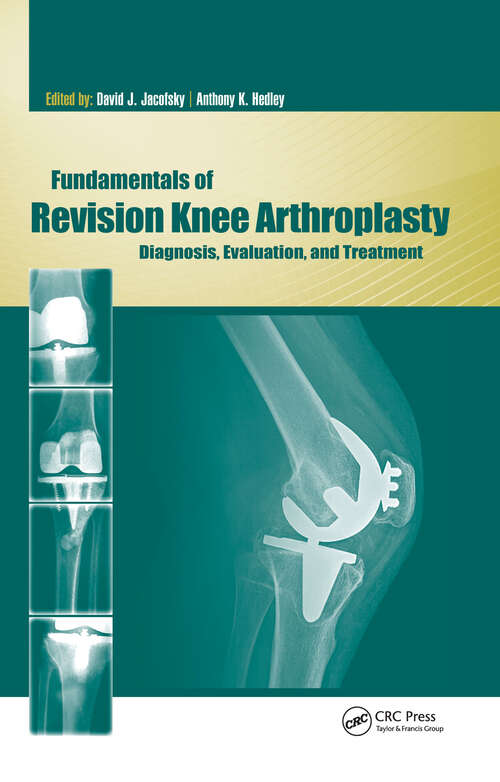 Book cover of Fundamentals of Revision Knee Arthroplasty: Diagnosis, Evaluation, and Treatment