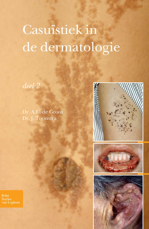 Book cover of Casuïstiek in de dermatologie deel 2