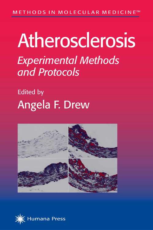 Book cover of Atherosclerosis: Experimental Methods and Protocols (Methods in Molecular Medicine #52)