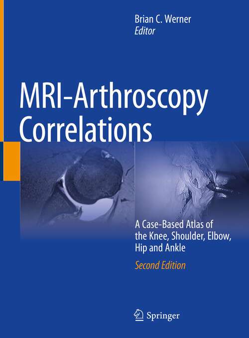 Book cover of MRI-Arthroscopy Correlations: A Case-Based Atlas of the Knee, Shoulder, Elbow, Hip and Ankle (2nd ed. 2022)