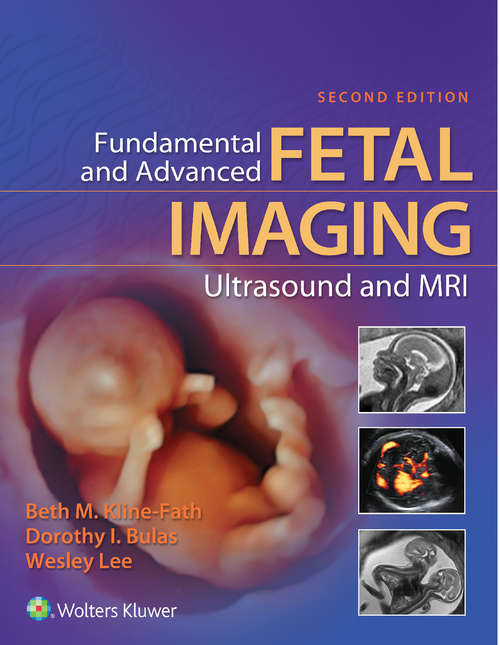 Book cover of Fundamental and Advanced Fetal Imaging Ultrasound and MRI: Ultrasound And Mri