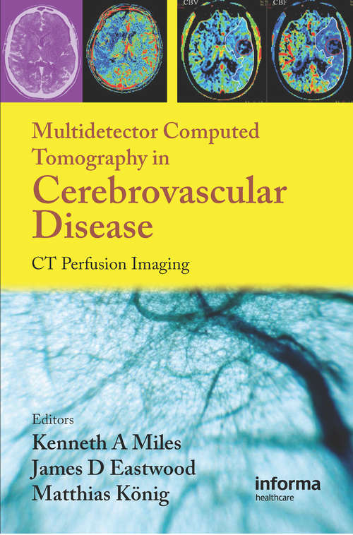 Book cover of Multidetector Computed Tomography in Cerebrovascular Disease: CT Perfusion Imaging