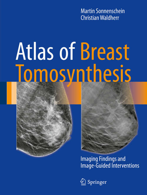 Book cover of Atlas of Breast Tomosynthesis: Imaging Findings and Image-Guided Interventions