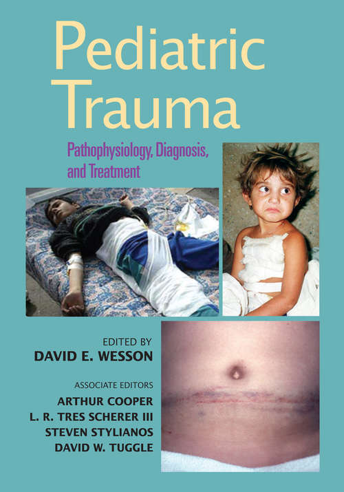 Book cover of Pediatric Trauma: Pathophysiology, Diagnosis, and Treatment (1)